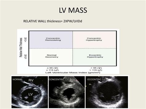 lv wall thickness echo|Lv wall thickness normal values.